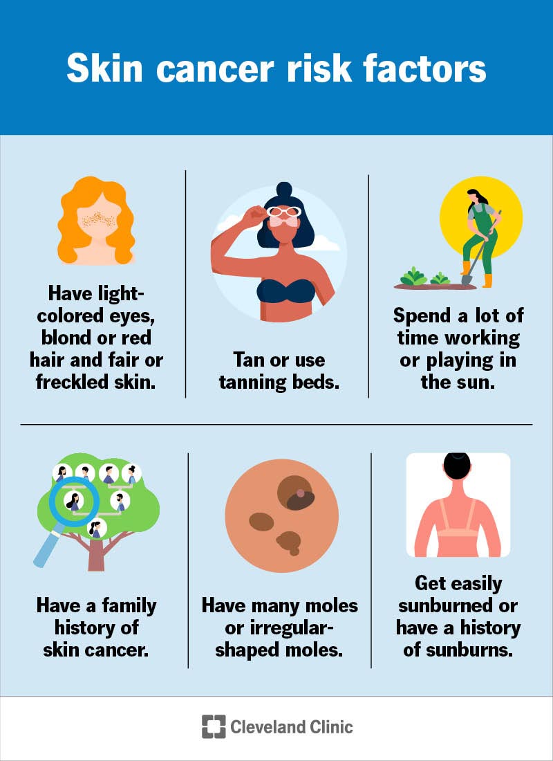 Preventing Cancer Tips Skin Cancer: Causes, Symptoms, and Prevention Tips – AFSPA